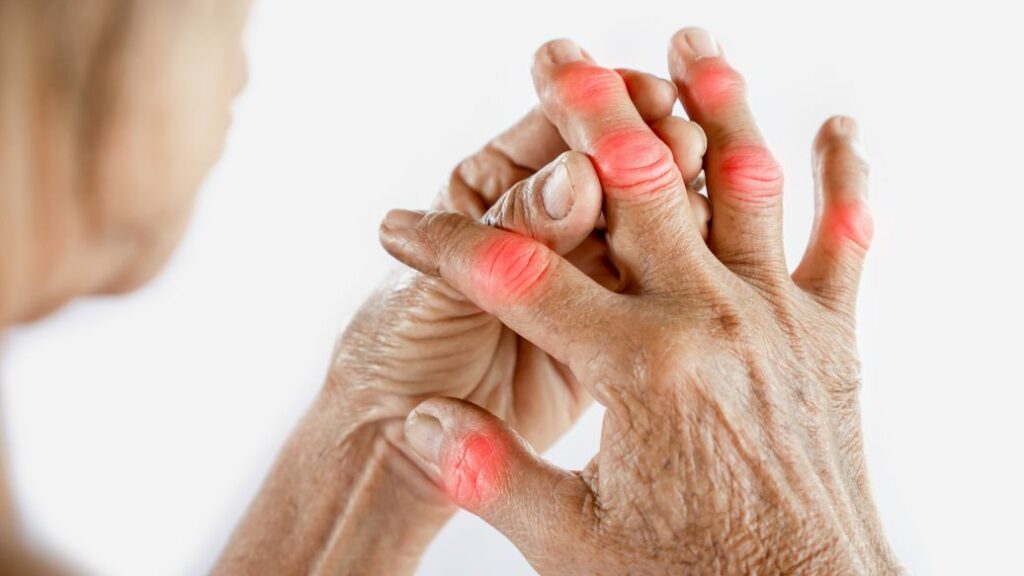 gout treatment