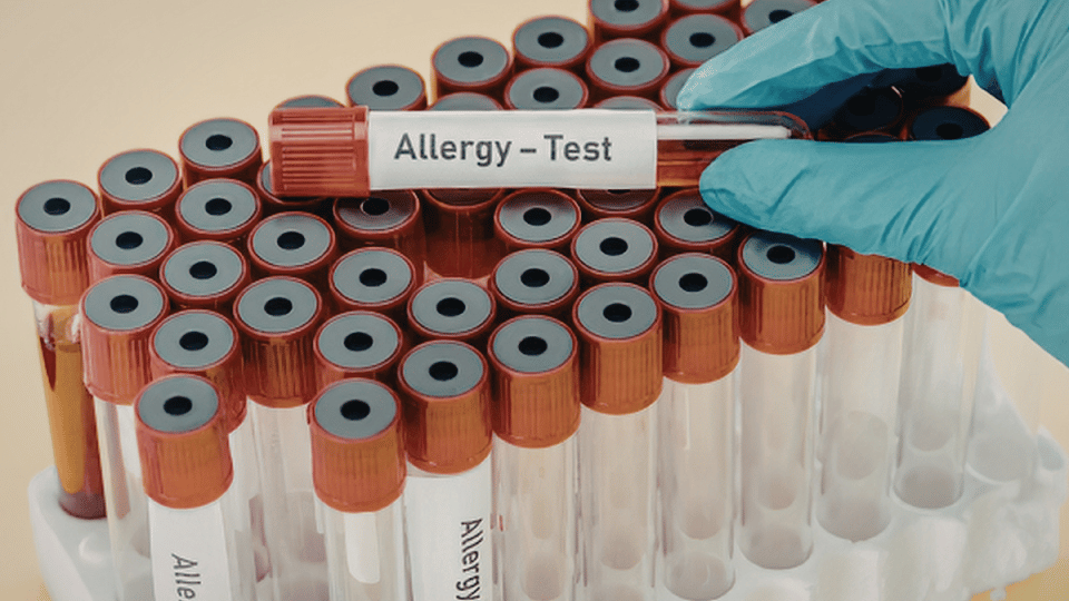 Allergy Testing