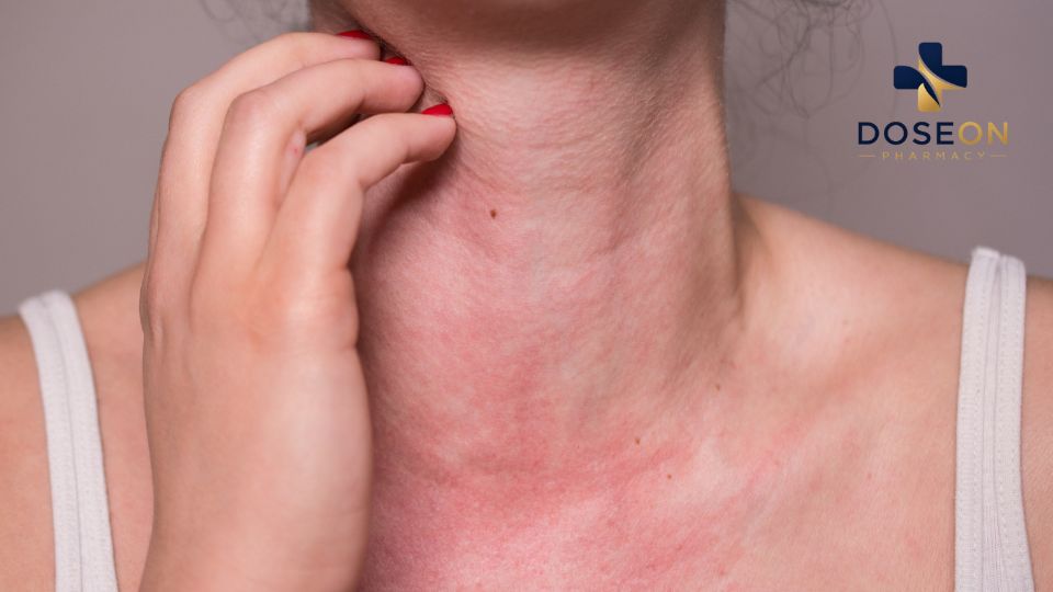 Allergy Testing