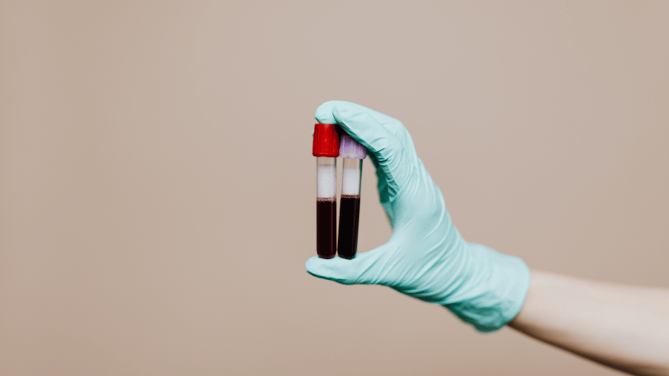 Blood Testing Service