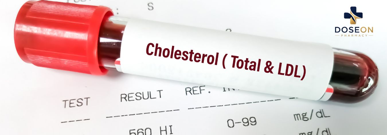 Cholesterol check blood test 