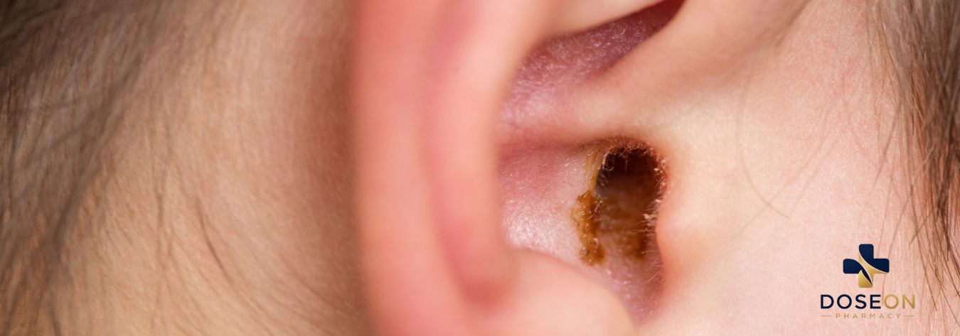 Earwax build up